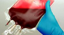 Ethja Ebola: mund të jetë i nevojshëm transfuzioni i gjakut.