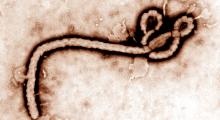 Ethja Ebola: agjenti shkaktar është virusi Ebola.