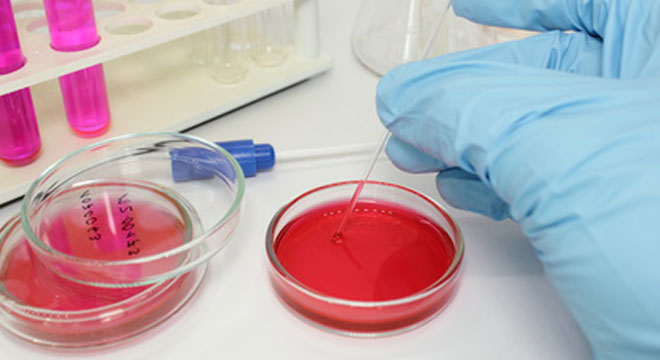 Ekzaminimi fungal: identifikimi i kërpudhave patogjene